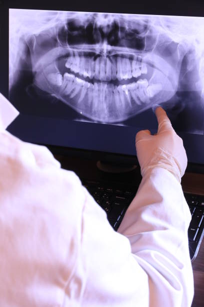 Best Emergency Treatment for Dental Infections or Abscesses in Desert Aire, WA